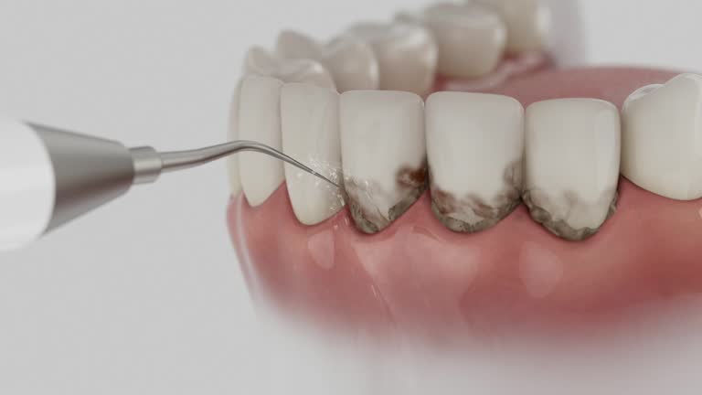 Trusted Dental Crowns And Bridges service in McCullom Lake, IL - Dentist Open Now